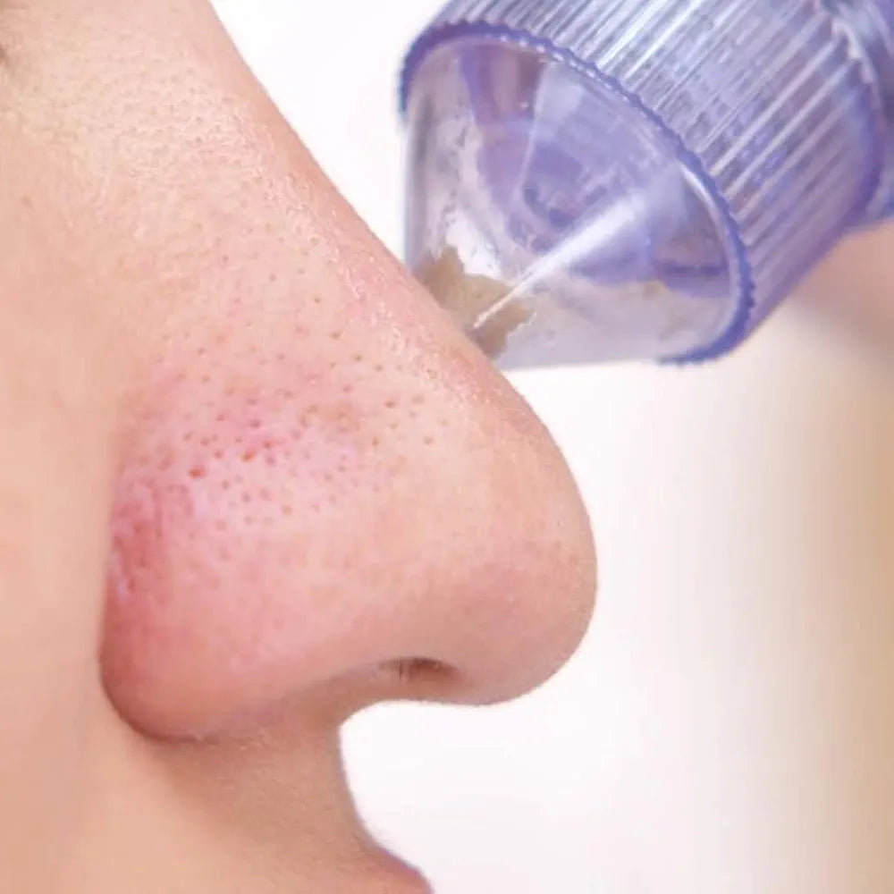 Seicca™ Vacuum Blackhead Remover – Deep Pore Cleaner for Clear, Smooth & Acne-Free Skin