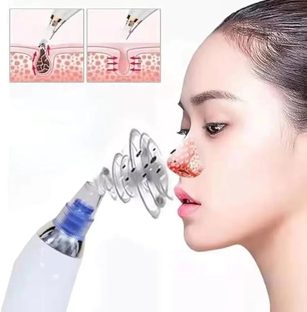 Seicca™ Vacuum Blackhead Remover – Deep Pore Cleaner for Clear, Smooth & Acne-Free Skin