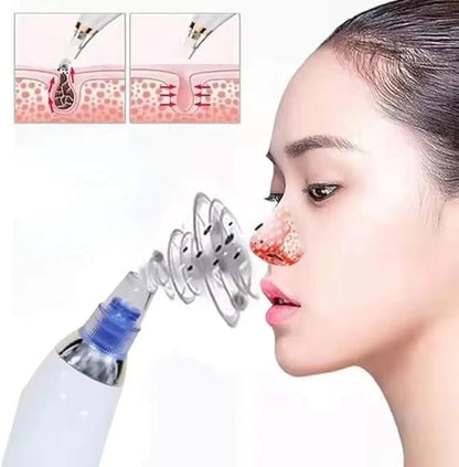 Seicca™ Vacuum Blackhead Remover – Deep Pore Cleaner for Clear, Smooth & Acne-Free Skin